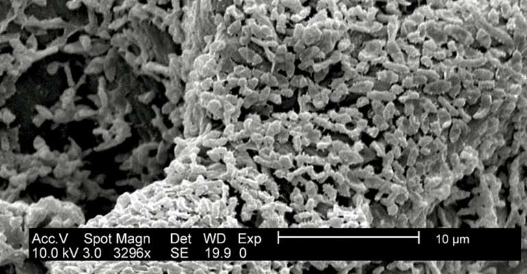 Biofilms en la industria alimentaria