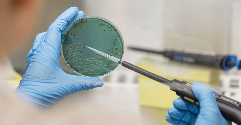 Un estudio alerta de los riesgos de contaminación cruzada durante la elaboración de zumos sin pasteurizar